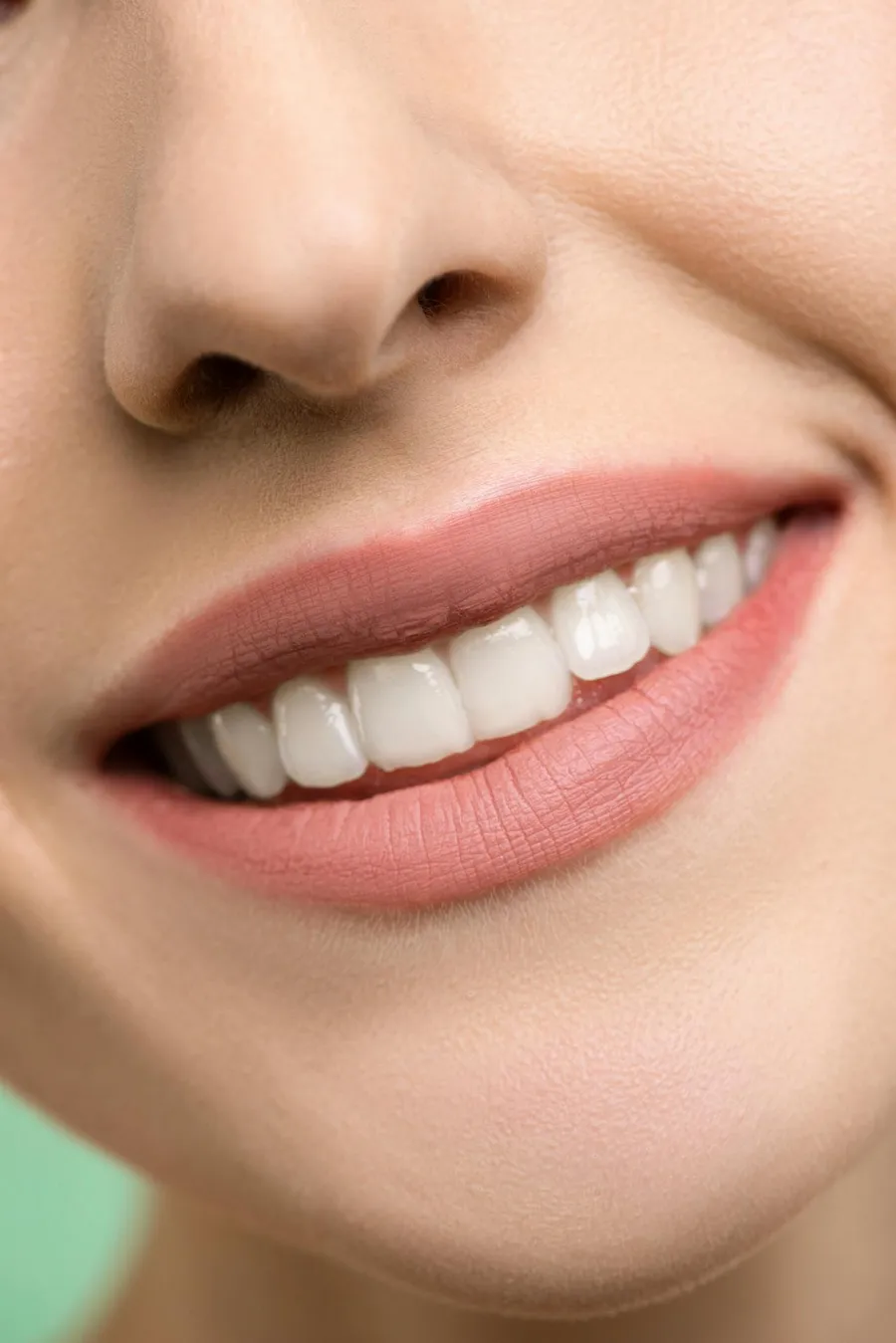 Beautiful smile design result showing natural-looking veneers achieved at Taki Dent, Antalya, Turkey