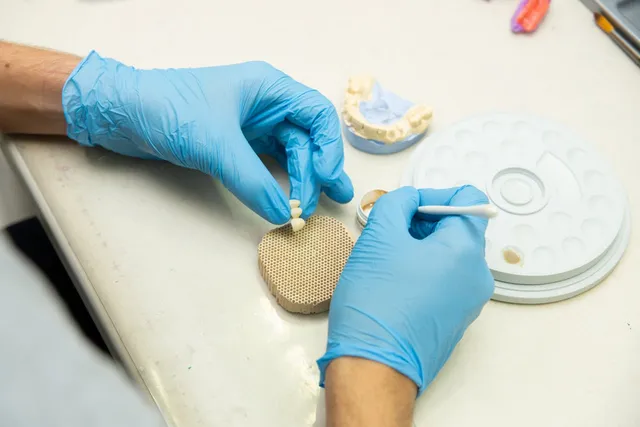 Zirconium crown fabrication at a dental laboratory