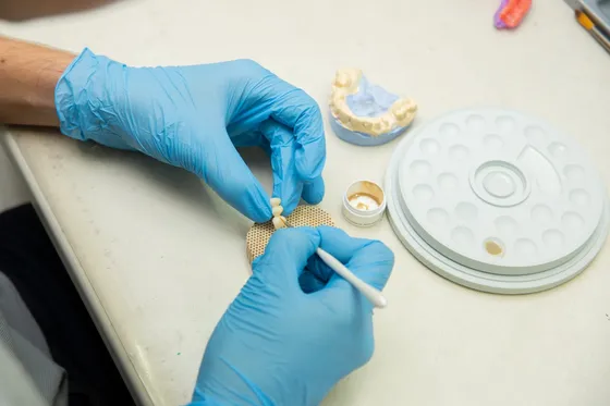 Dental laboratory technician using precision tools to craft a veneer restoration — quality lab work at clinics in Turkey