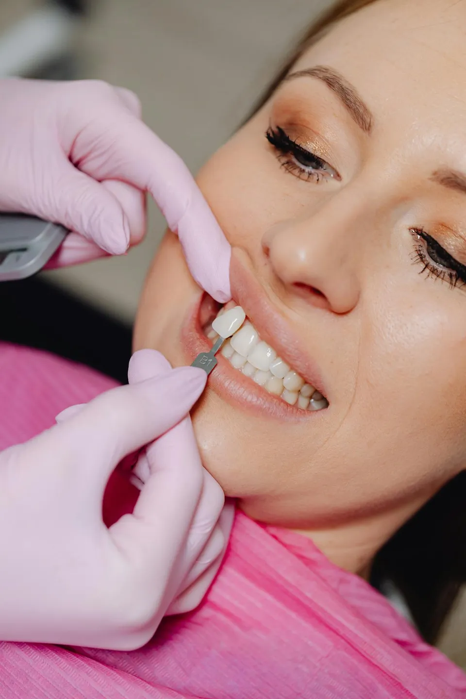 Smile design procedure in progress at a specialist dental clinic in Antalya, Turkey