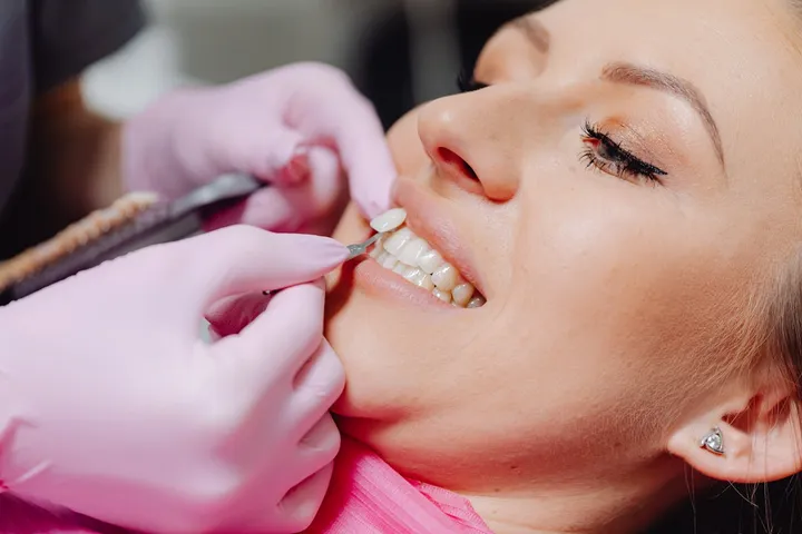 Veneer application procedure being performed