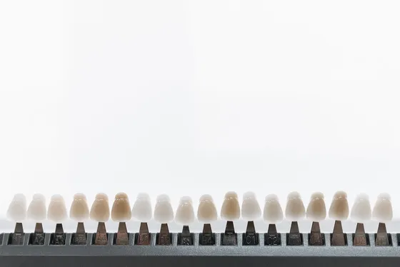 Veneer shade selection rack used at a specialist smile design clinic in Turkey — precise colour matching for natural-looking results